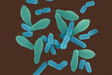 Improved control of foodborne Clostridium